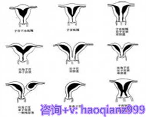 青岛私立供卵可靠吗，青岛高龄供卵试管的优点