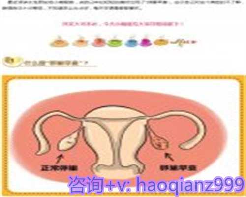 青岛供卵自怀生殖中心，青岛妇女儿童医院的供卵服务