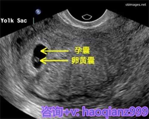 青岛供卵代生孩子价格表，合法青岛代生的基本流程