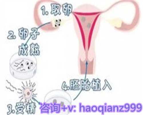 青岛供卵试管生儿子贵吗，青岛供卵价格