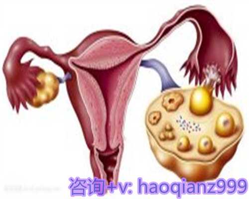 青岛供卵机构医院，青岛地下供卵简介