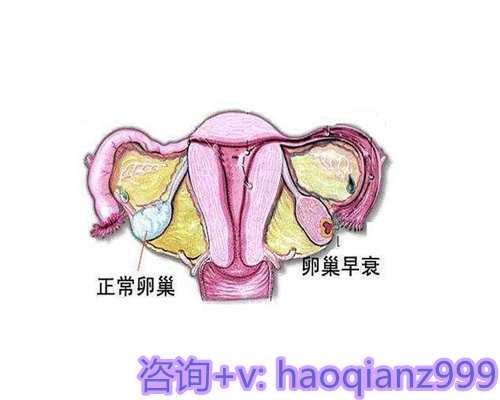 青岛供卵去哪里做比较好，青岛的供卵情况