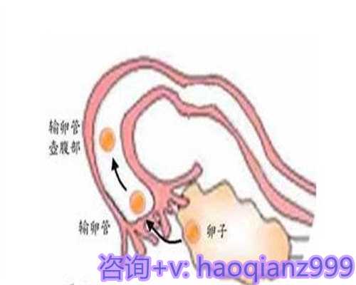 青岛供卵机构是不是真的， 青岛供卵助孕市场价格表