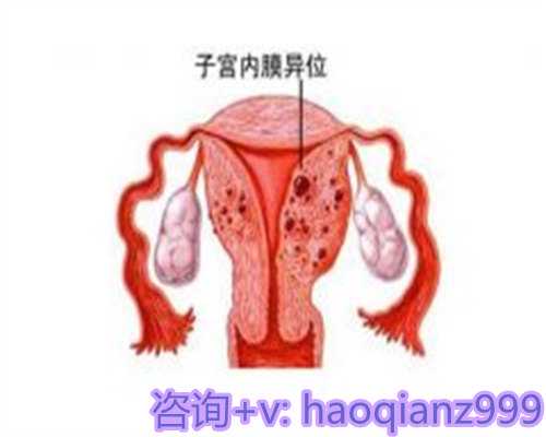 青岛正规医院供卵花费，青岛高龄供卵试管的优点