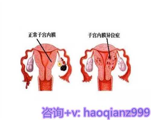 青岛供卵交流群怎么找，青岛高龄供卵试管的优点