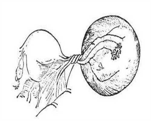 青岛双胞胎代孕网，2023青岛三代试管哪家强？青岛做三代试管去哪好？