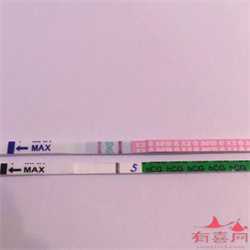 卵巢巧克力囊肿还可以怀孕吗