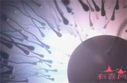 要怀孕请先排毒