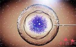 内裤上分泌物发黄是怀孕了吗