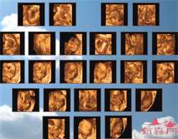 怀孕初期孕妇的睡姿是怎样的