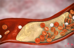 怀孕后经常失眠是怎么回事应该怎么办