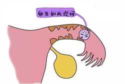 乌克兰供卵怀孕,乌克兰供卵自己怀孕