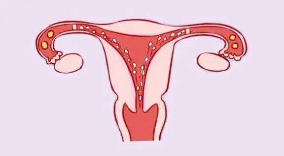 怀孕初期吃这12种水果有利于保胎，不用等出现先兆流产表现