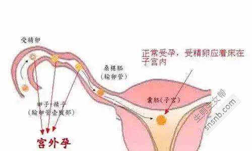 乙型肝炎病毒DNA荧光定量检测结果:1E+4是什么意思？可以怀孕吗？
