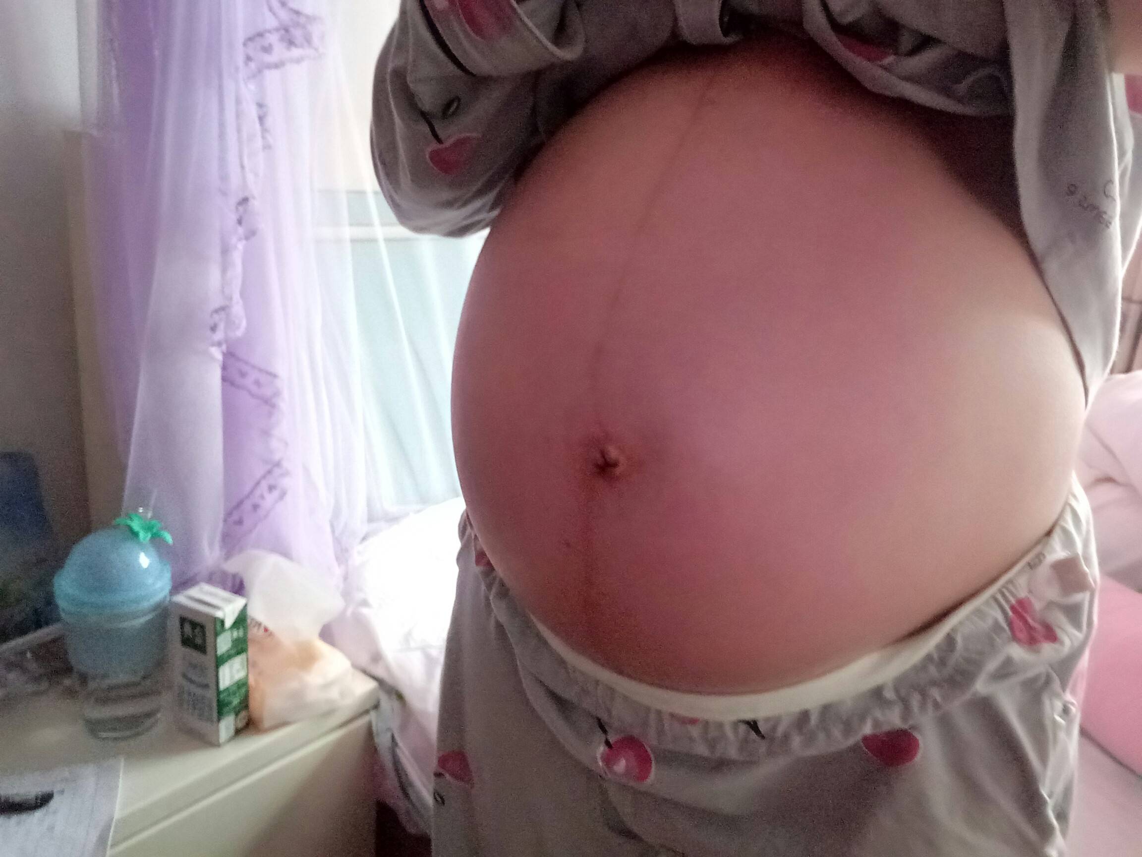 我现在怀孕15周了，上周去医院建卡，查出来有霉菌性阴道炎，是否