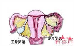 怀孕1个月有哪些反应？妇产科医生这样说