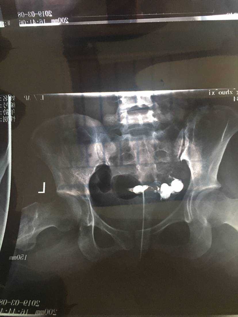 吃了避孕药怀孕了孩子能要吗