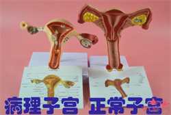 怀孕恶心怎么回事