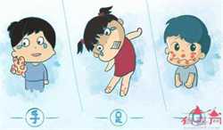 怀孕6个月全身痒怎么回事？是过敏了吗？