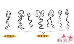 左侧优势卵泡有什么方法同房提高怀孕几率？