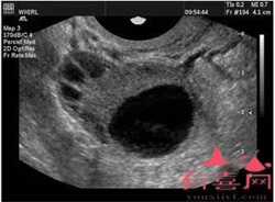 怀孕2个月怎么看男女
