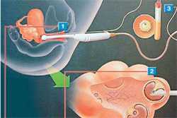 怀孕15天左右能做B超吗？求解？？？？