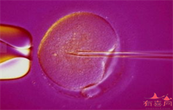 怀孕多久可以测男女