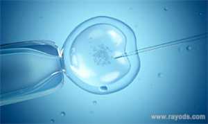 怀孕四个月尿少正常吗