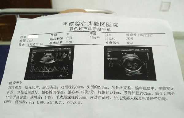 孕早期有鲜血无腹痛是怎么了