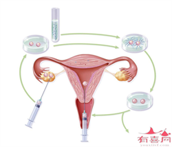 怀孕4周hcg低怎么办