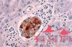 孕妇要不要吃什么DHA的婴儿补脑。