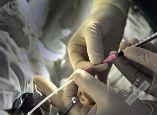 怀孕初期出血怎么办