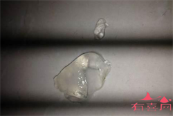 妇科医生谈生育：月经未至也可能怀孕