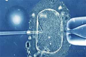 胎儿脐带绕颈3圈怎么办？