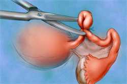 怀孕一个月可以同房吗？孕早期建议不要