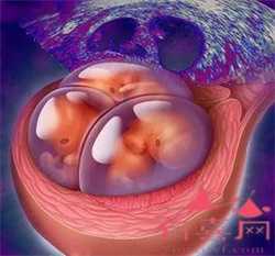 宝宝眼屎多的饮食护理,宝宝眼屎多怎么办