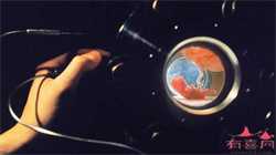 产前恐惧症是什么