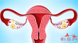 宫颈息肉的危害有多大