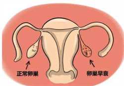 胎位检查是什么