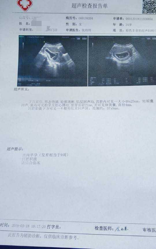 孕妇牙刷有用吗