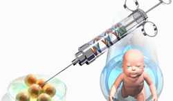 下肢静脉曲张系列一