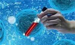 怀孕4周出现褐色分泌物是什么原因