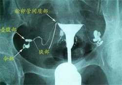 解答：怀孕初期有哪些症状