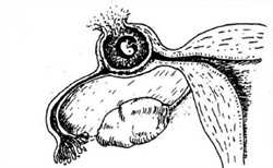 怀孕为什么不可以吃桃子