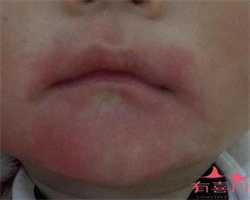 网友经验：怀孕前要做的6个准备