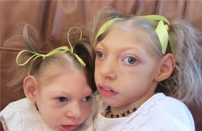 怀孕一周雌二醇正常值