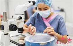 产后肚子还有一条黑线肚脐眼也是黑的正常吗