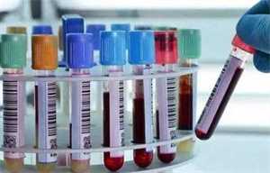 用体温计测体温什么时候最易同房最易受孕？