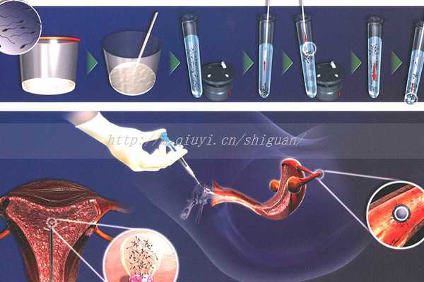 〖青岛试管三代医生排名〗青岛试管三代